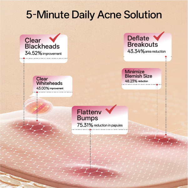 Silk'n acne patch for fast-acting pimple spot treatment and healing